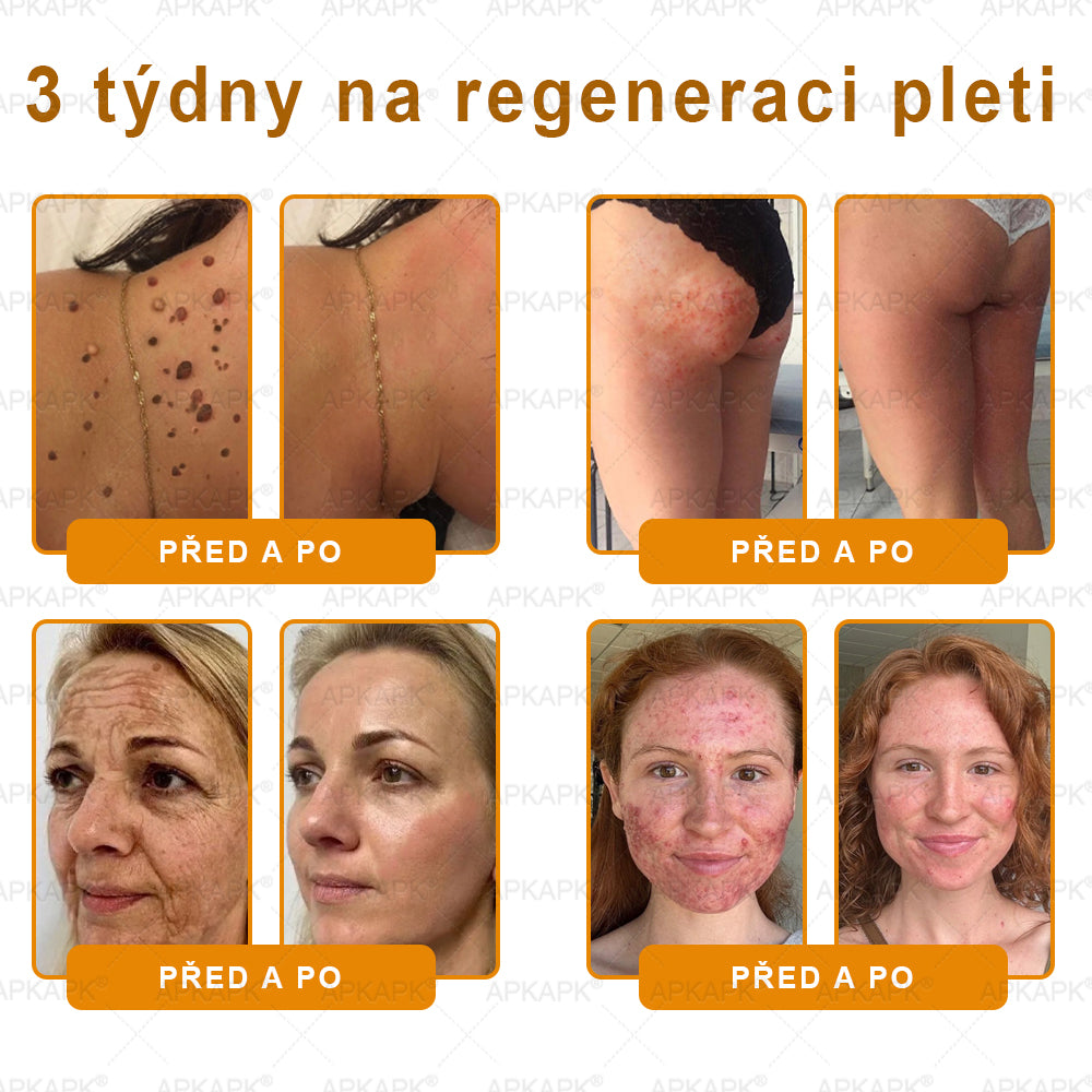 Dermatologicky a klinicky testováno👩‍⚕️APKAPK®Bee Venom Krém na obnovení pleti🐝 pomáhá při léčbě kožních problémů, jako jsou: vrásky, jizvy, pigmentové skvrny, strie, akné, psoriáza, ekzém, kožní změny, podráždění, záněty a další kožní problémy.