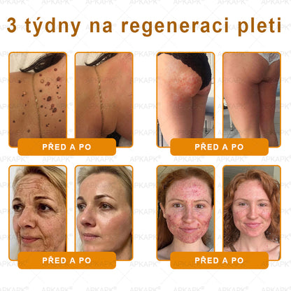Dermatologicky a klinicky testováno👩‍⚕️APKAPK®Bee Venom Krém na obnovení pleti🐝 pomáhá při léčbě kožních problémů, jako jsou: vrásky, jizvy, pigmentové skvrny, strie, akné, psoriáza, ekzém, kožní změny, podráždění, záněty a další kožní problémy.