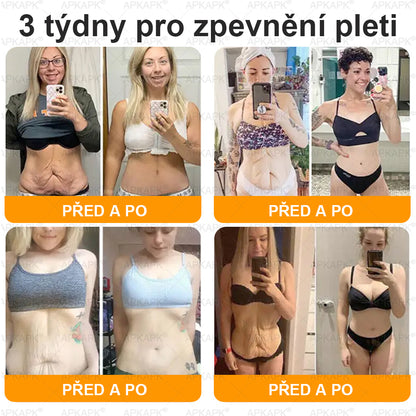 Dermatologicky a klinicky testováno👩‍⚕️APKAPK®Bee Venom Krém na obnovení pleti🐝 pomáhá při léčbě kožních problémů, jako jsou: vrásky, jizvy, pigmentové skvrny, strie, akné, psoriáza, ekzém, kožní změny, podráždění, záněty a další kožní problémy.