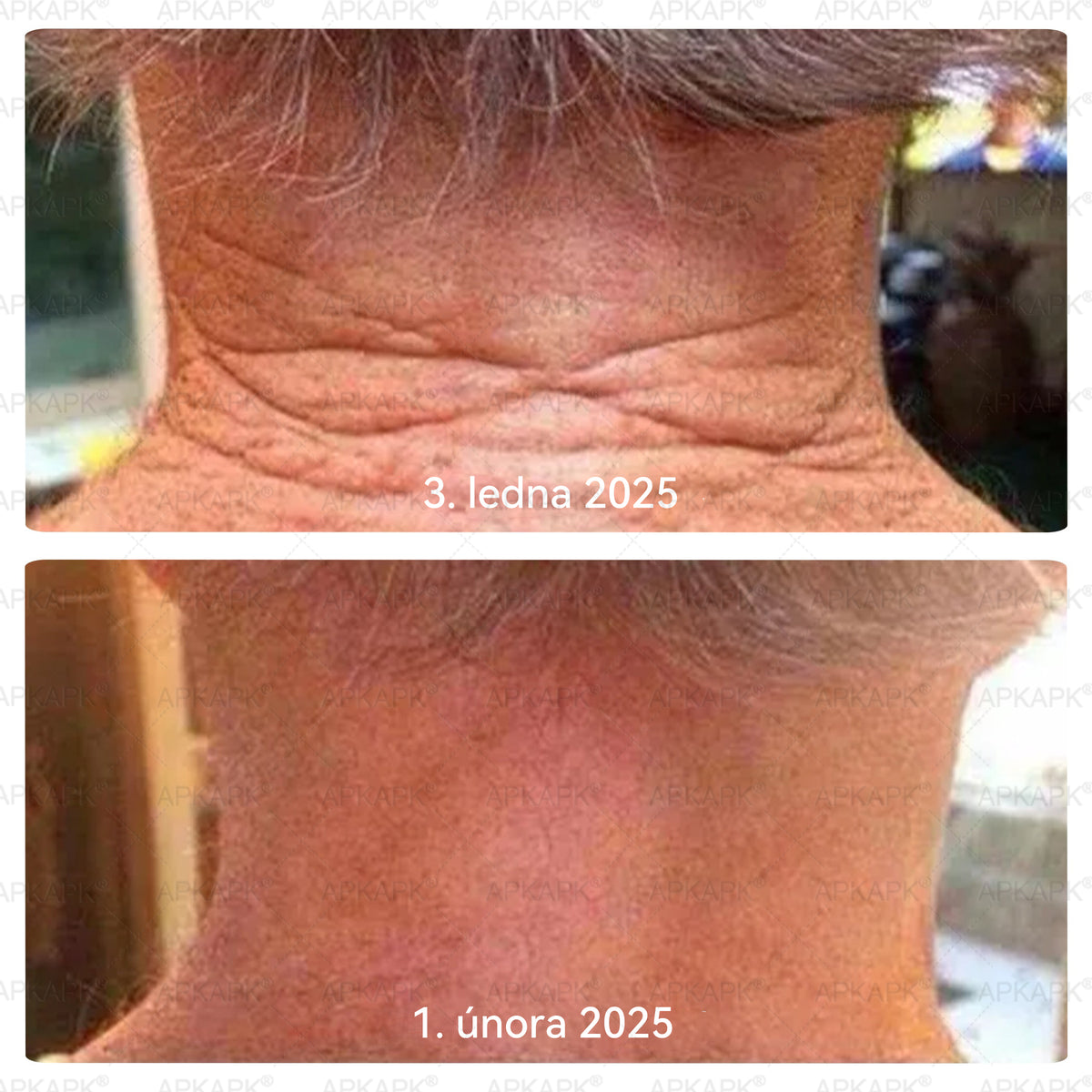 Dermatologicky a klinicky testováno👩‍⚕️APKAPK®Bee Venom Krém na obnovení pleti🐝 pomáhá při léčbě kožních problémů, jako jsou: vrásky, jizvy, pigmentové skvrny, strie, akné, psoriáza, ekzém, kožní změny, podráždění, záněty a další kožní problémy.