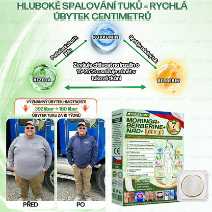 𝐆𝐞𝑒𝑙𝑒𝐦𝐨𝐧® 👩‍⚕️ Glum𝐚𝐬𝐞tide 8 v 1 – Zeštíhlující nano mikrojihlový náplas(Pouze jednou denně, viditelné změny již za 7 dní)  Určeno pro osoby s obezitou, diabetem, spánkovou apnoe