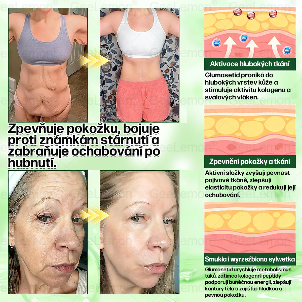 Oficiální český obchod ✨ 𝐆𝐞𝐞𝐋𝐞𝐦𝐨𝐧® 8v1 Nanomikrojehlicové náplasti na formování těla 🇨🇿 Pouze 1 použití denně ✅ Výsledky viditelné již za 7 dní – vhodné pro obezitu, kardiovaskulární zdraví, cukrovku a problémy s klouby. (Copy)