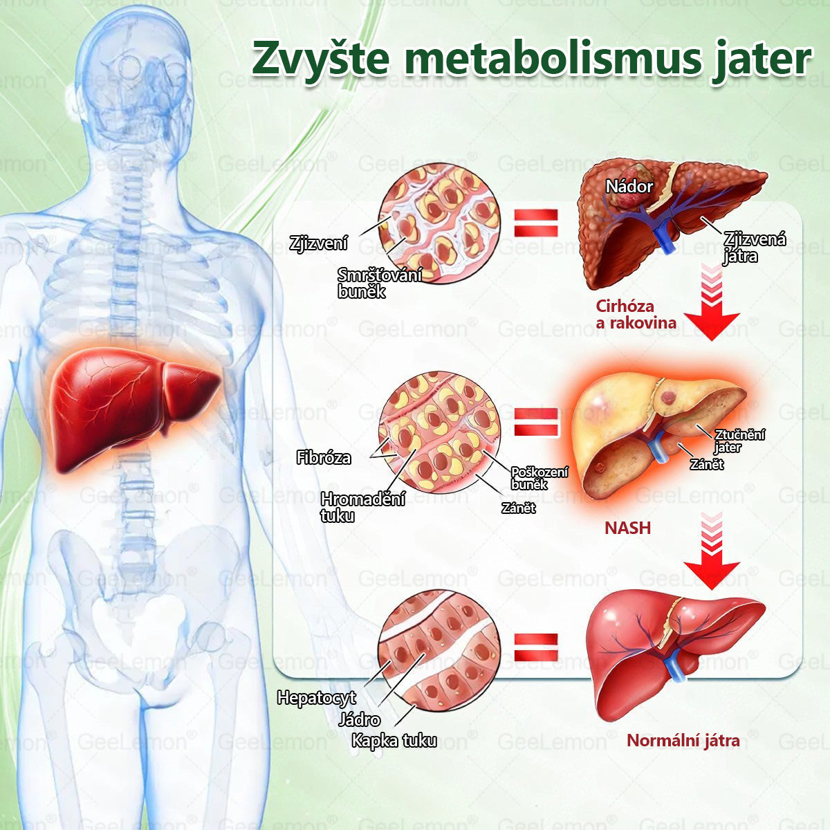 Oficiální český obchod ✨ 𝐆𝐞𝐞𝐋𝐞𝐦𝐨𝐧® 8v1 Nanomikrojehlicové náplasti na formování těla 🇨🇿 Pouze 1 použití denně ✅ Výsledky viditelné již za 7 dní – vhodné pro obezitu, kardiovaskulární zdraví, cukrovku a problémy s klouby. (Copy)