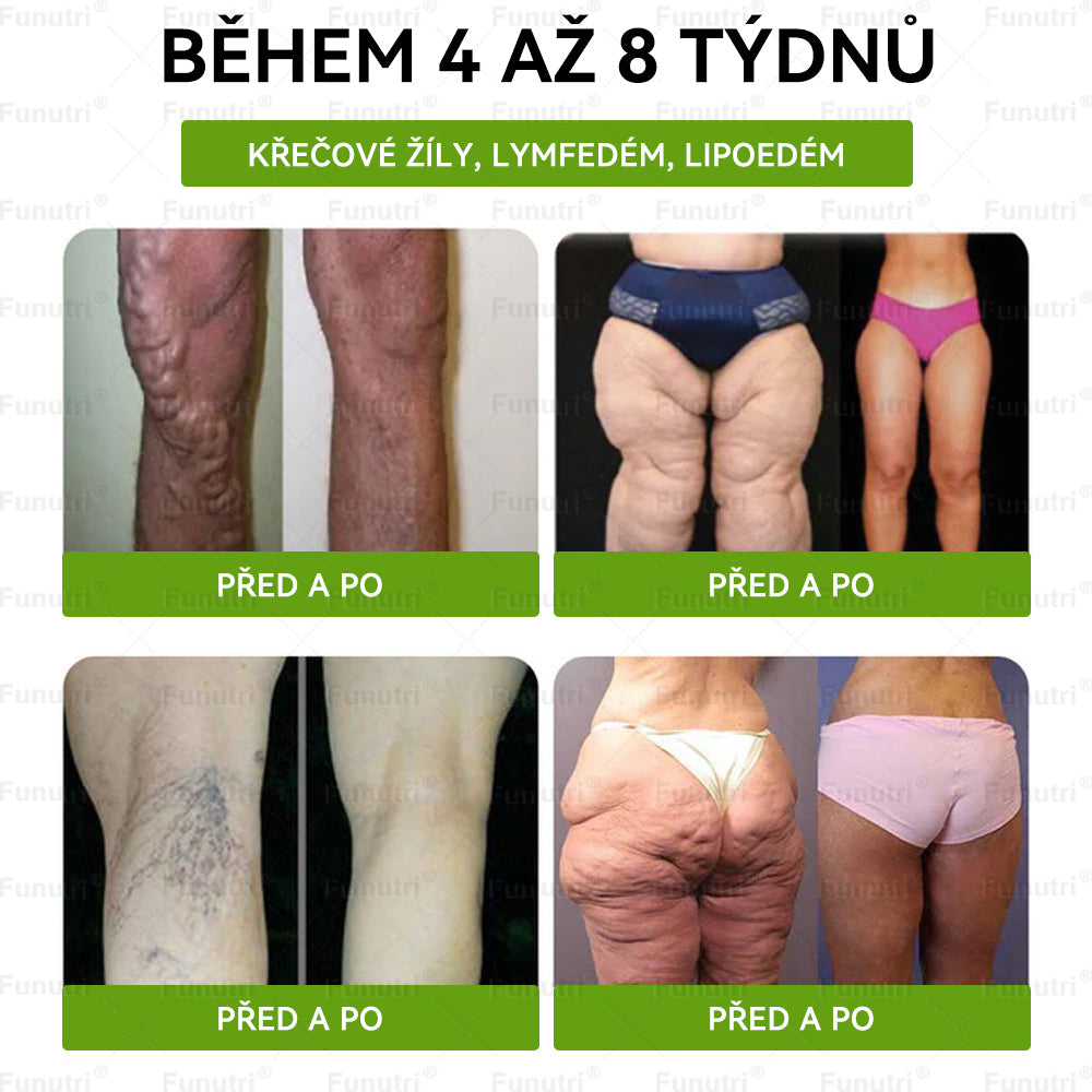 Oficiální obchod | 👩‍⚕️ Funutri® 10 v 1 metabolická tvarující náplast s nano mikrojehličkami  (Pouze jednou denně, viditelné změny již za 7 dní)  Určeno pro osoby s obezitou, diabetem, spánkovou apnoe