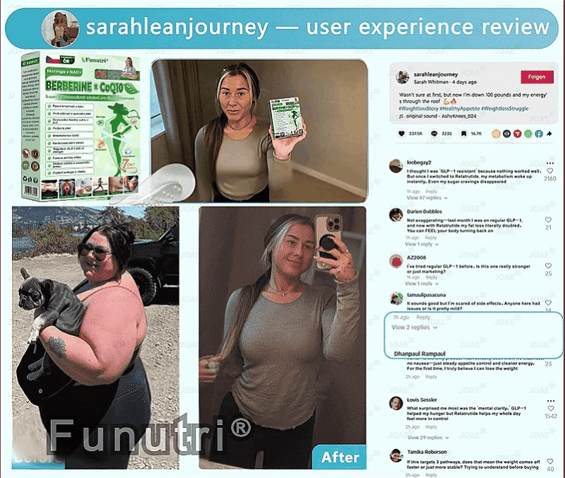 Oficiální obchod | 👩‍⚕️ Funutri® 10 v 1 metabolická tvarující náplast s nano mikrojehličkami  (Pouze jednou denně, viditelné změny již za 7 dní)  Určeno pro osoby s obezitou, diabetem, spánkovou apnoe