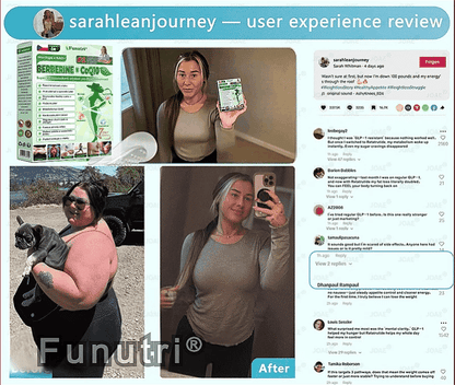 Oficiální obchod | 👩‍⚕️ Funutri® 10 v 1 metabolická tvarující náplast s nano mikrojehličkami  (Pouze jednou denně, viditelné změny již za 7 dní)  Určeno pro osoby s obezitou, diabetem, spánkovou apnoe