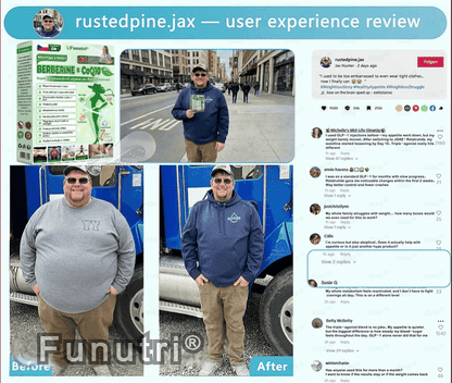 Oficiální obchod | 👩‍⚕️ Funutri® 10 v 1 metabolická tvarující náplast s nano mikrojehličkami  (Pouze jednou denně, viditelné změny již za 7 dní)  Určeno pro osoby s obezitou, diabetem, spánkovou apnoe