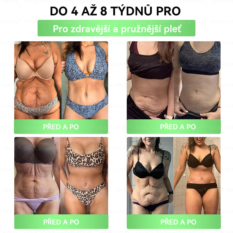 🎁🎁 GeeLemon® – 🎁 Na skladě už jen 5 balení! Nabízíme dodatečnou slevu 50 %! Dostaňte se do formy a zlepšete své zdraví. Pokud tuto příležitost propásnete, další šance bude až příští rok.