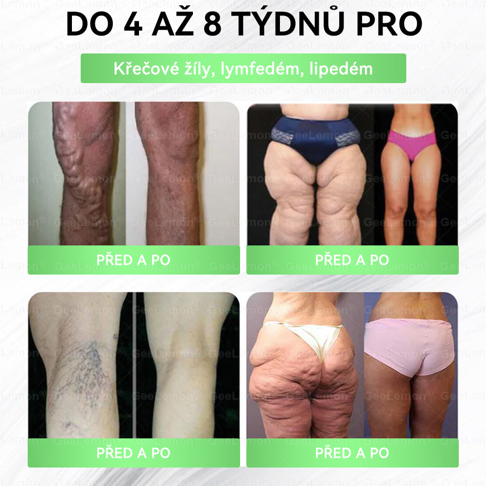 𝐆𝐞𝑒𝑙𝑒𝐦𝐨𝐧® 👩‍⚕️ Glum𝐚𝐬𝐞tide 8 v 1 – Zeštíhlující nano mikrojihlový náplas(Pouze jednou denně, viditelné změny již za 7 dní)  Určeno pro osoby s obezitou, diabetem, spánkovou apnoe