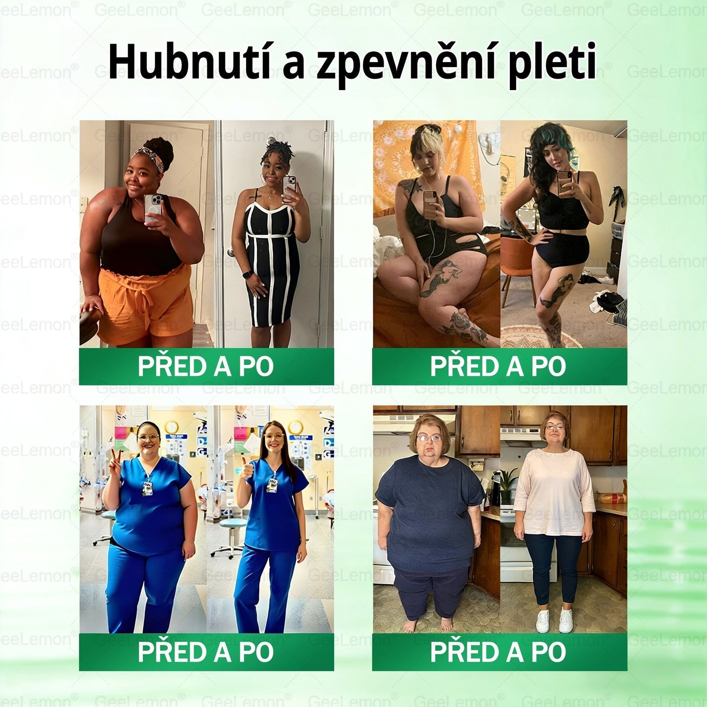 𝐆𝐞𝑒𝑙𝑒𝐦𝐨𝐧® 👩‍⚕️ Glum𝐚𝐬𝐞tide 8 v 1 – Zeštíhlující nano mikrojihlový náplas(Pouze jednou denně, viditelné změny již za 7 dní)  Určeno pro osoby s obezitou, diabetem, spánkovou apnoe