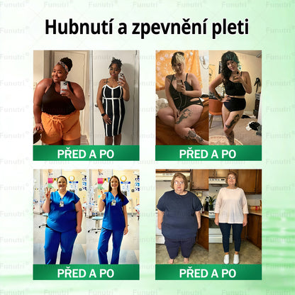 Oficiální obchod | 👩‍⚕️ Funutri® 10 v 1 metabolická tvarující náplast s nano mikrojehličkami  (Pouze jednou denně, viditelné změny již za 7 dní)  Určeno pro osoby s obezitou, diabetem, spánkovou apnoe