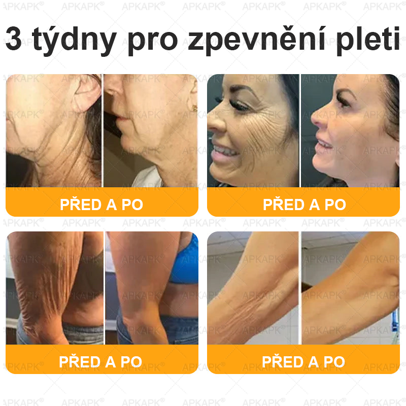 Dermatologicky a klinicky testováno👩‍⚕️APKAPK®Bee Venom Krém na obnovení pleti🐝 pomáhá při léčbě kožních problémů, jako jsou: vrásky, jizvy, pigmentové skvrny, strie, akné, psoriáza, ekzém, kožní změny, podráždění, záněty a další kožní problémy.