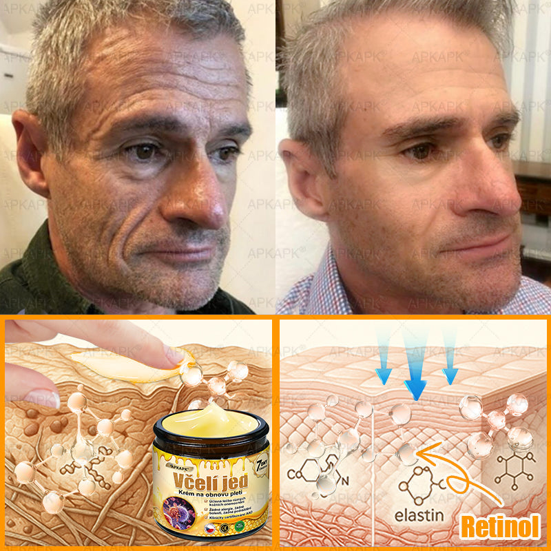 Dermatologicky a klinicky testováno👩‍⚕️APKAPK®Bee Venom Krém na obnovení pleti🐝 pomáhá při léčbě kožních problémů, jako jsou: vrásky, jizvy, pigmentové skvrny, strie, akné, psoriáza, ekzém, kožní změny, podráždění, záněty a další kožní problémy.