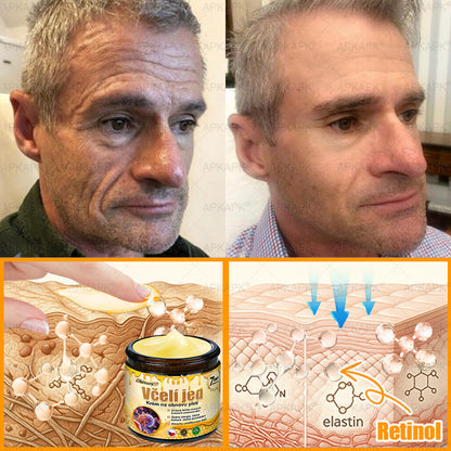 Dermatologicky a klinicky testováno👩‍⚕️APKAPK®Bee Venom Krém na obnovení pleti🐝 pomáhá při léčbě kožních problémů, jako jsou: vrásky, jizvy, pigmentové skvrny, strie, akné, psoriáza, ekzém, kožní změny, podráždění, záněty a další kožní problémy.