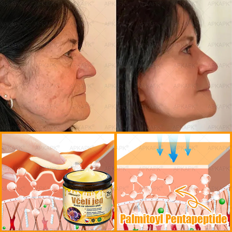 𝖠𝖯𝖪𝖠𝖯𝖪® 🐝 Krém s včelím jedem na obnovu pokožky 🐝 pomáhá při řešení kožních problémů, jako jsou: vrásky, jizvy, pigmentové skvrny, strie, akné, lupénka, ekzém, kožní léze, podráždění, záněty a další kožní potíže.