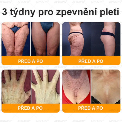 Dermatologicky a klinicky testováno👩‍⚕️APKAPK®Bee Venom Krém na obnovení pleti🐝 pomáhá při léčbě kožních problémů, jako jsou: vrásky, jizvy, pigmentové skvrny, strie, akné, psoriáza, ekzém, kožní změny, podráždění, záněty a další kožní problémy.