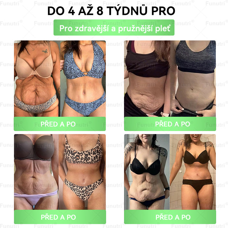Oficiální obchod | 👩‍⚕️ Funutri® 10 v 1 metabolická tvarující náplast s nano mikrojehličkami  (Pouze jednou denně, viditelné změny již za 7 dní)  Určeno pro osoby s obezitou, diabetem, spánkovou apnoe